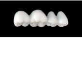 Cod.S1LOWER LEFT : 15x  posterior solid (not hollow) wax bridges, LARGE , (37-34) , with precarved occlusion to Cod.S1UPPER LEFT,and compatible to Cod.E1LOWER LEFT (hollow), (37-34)